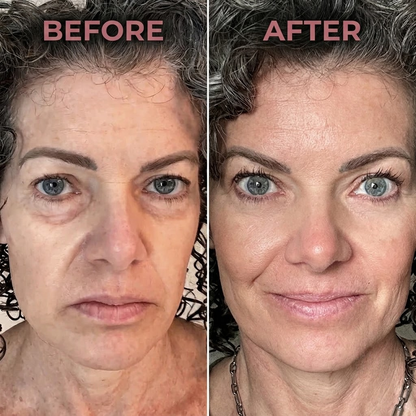 Brighter Eyes In Minutes A Day